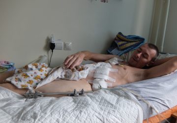 В ЖИВОТЕ ЛОПНУЛА ПОДЖЕЛУДОЧНАЯ, СЛОМАНЫ БЕДРО, ГОЛЕНОСТОП, РЕБРА, ГРУДИНА В ЖИВОТЕ ЛОПНУЛА ПОДЖЕЛУДОЧНАЯ, СЛОМАНЫ БЕДРО, ГОЛЕНОСТОП, РЕБРА, ГРУДИНА